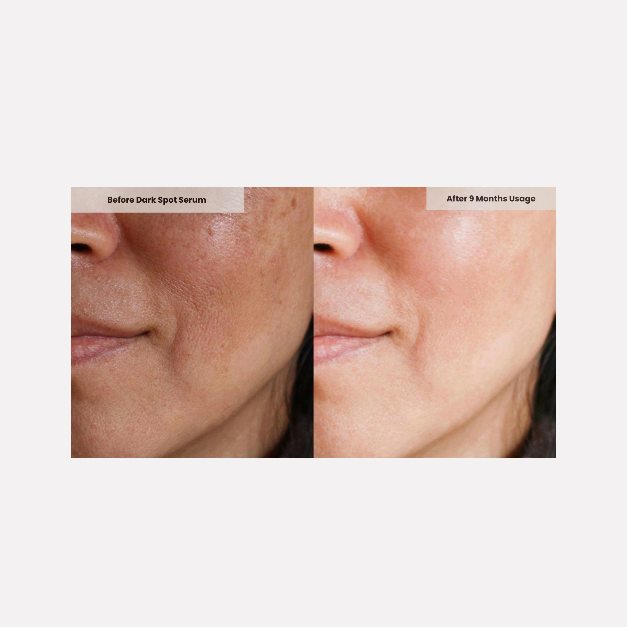 Dark Spot Serum for Sensitive Skin