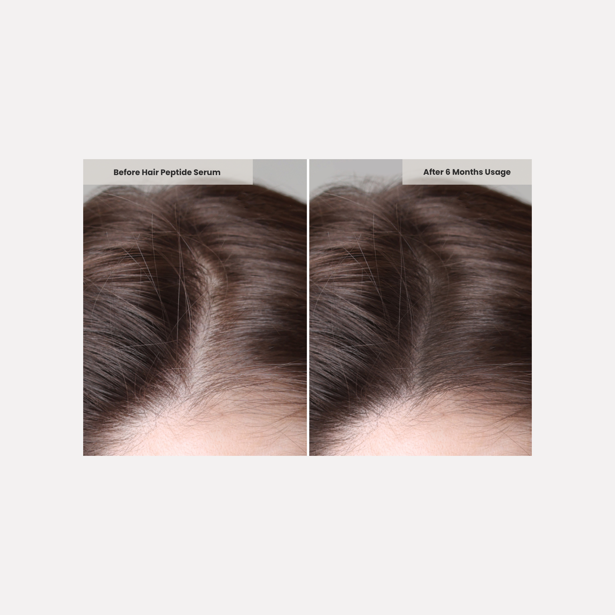 Peptide Hair Growth Serum