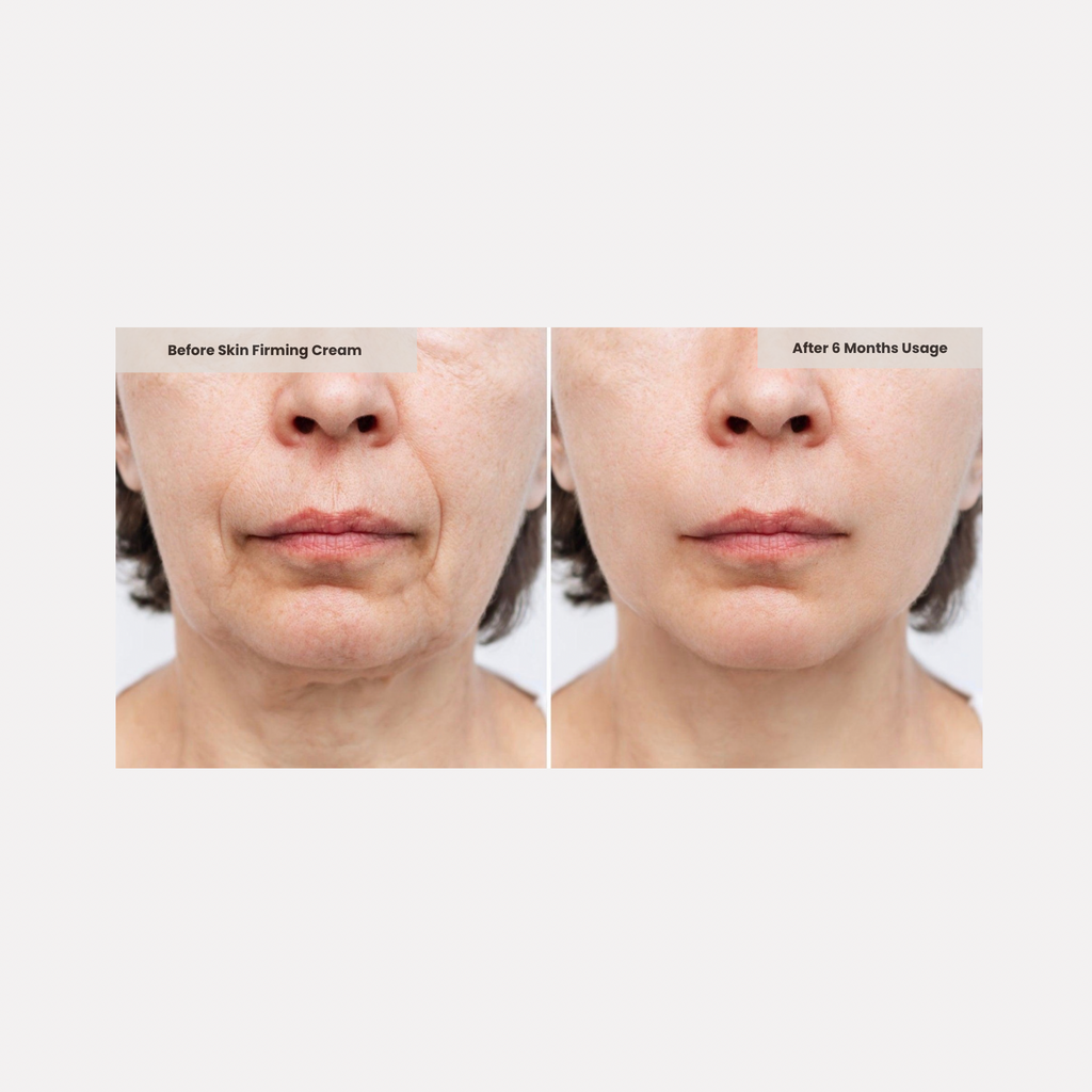 Skin Firming Cream