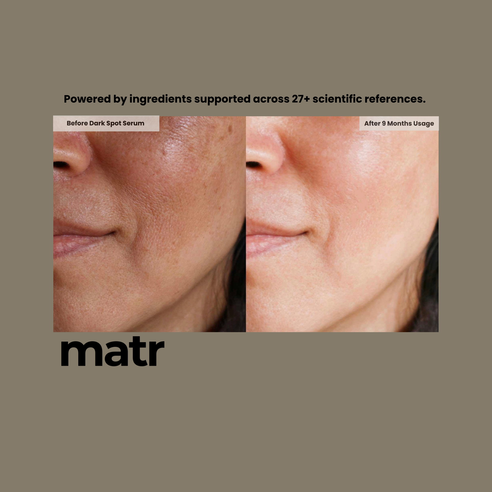 Dark Spot Serum with Alpha Arbutin & Niacinamide